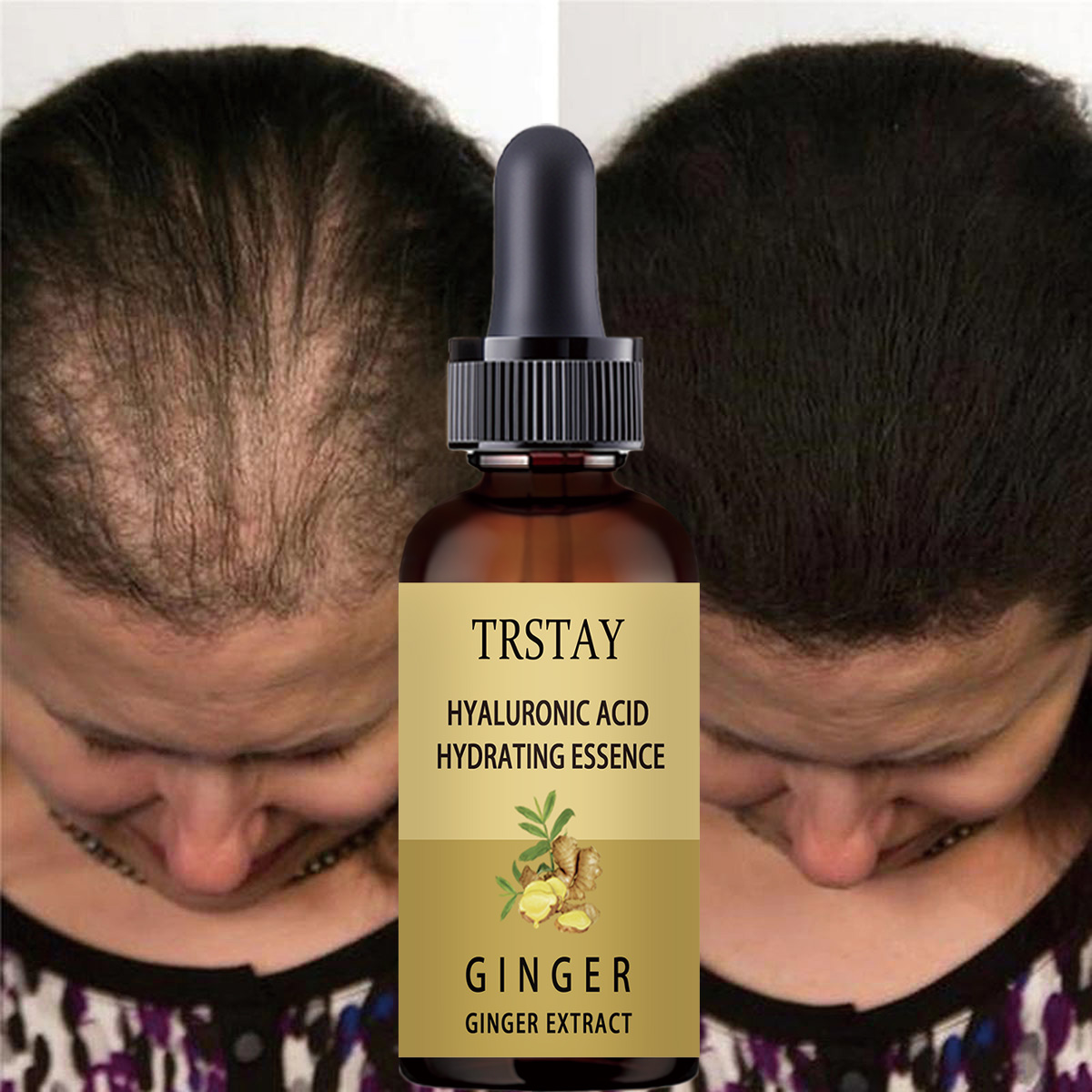 Hair Care Gisou - Serum na porost włosów zapobiegające wypadaniu
