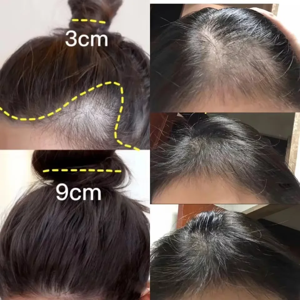 Szybki Krem na Porost Włosów I – Hair Care Dupes recenzja i cena